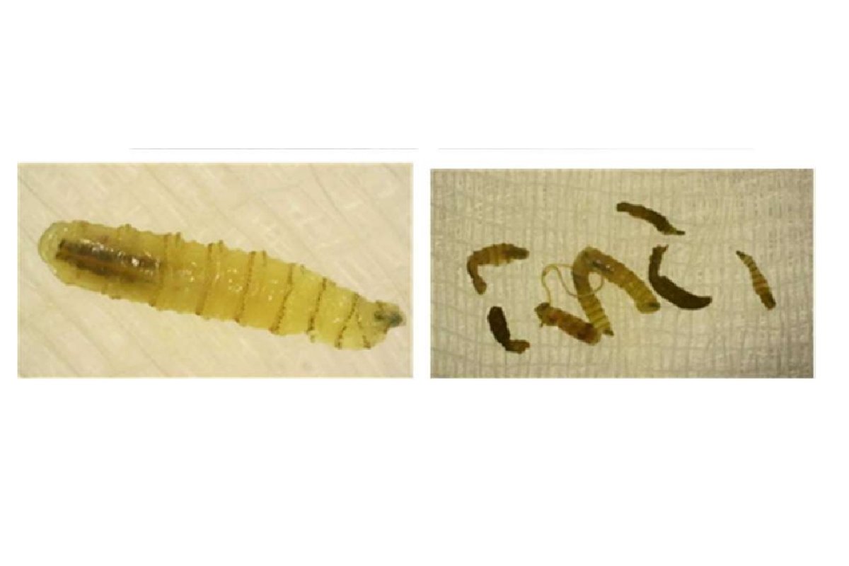 gusano-barrenador-en-humanos-1